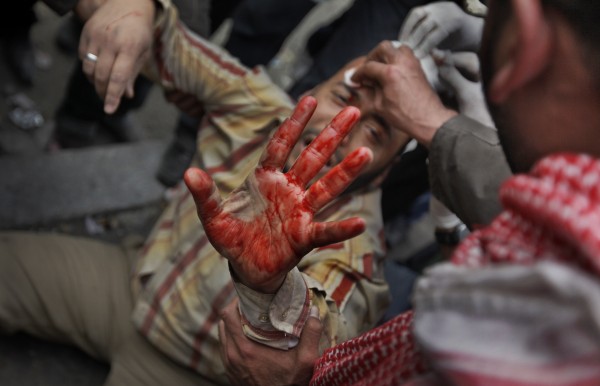A wounded anti-government protester holds up his bloodied hand as he is carried by others back from clashes with pro-government supporters near the Egyptian Museum in downtown Cairo, Egypt, Thursday, Feb. 3, 2011. Anti-government protesters and regime supporters clashed in a second day of rock-throwing battles, while gangs of thugs supporting Egyptian President Hosni Mubarak attacked reporters, foreigners and rights workers as the army rounded up foreign journalists and new looting and arson were reported. A wounded anti-government protester holds up his bloodied hand as he is carried by others back from clashes with pro-government supporters near the Egyptian Museum in downtown Cairo, Egypt, Thursday, Feb. 3, 2011. Anti-government protesters and regime supporters clashed in a second day of rock-throwing battles, while gangs of thugs supporting Egyptian President Hosni Mubarak attacked reporters, foreigners and rights workers as the army rounded up foreign journalists and new looting and arson were reported.