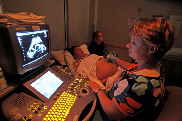 Kalia Yang and her boyfriend Andy Moua, background, watch an ultrasound image of their twin babies performed by technician Rita Siudak, foreground, at St. Josephs Hospital recently. The couple, who are married in the Hmong tradition, is expecting their babies in November. Kalia Yang and her boyfriend Andy Moua, background, watch an ultrasound image of their twin babies performed by technician Rita Siudak, foreground, at St. Josephs Hospital recently. The couple, who are married in the Hmong tradition, is expecting their babies in November.