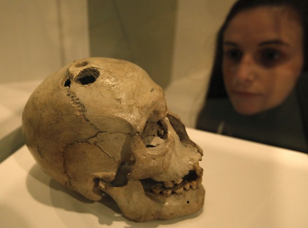 A Bronze Age skull from Jericho in the West Bank that shows four holes made by the ancient surgical process of trephination carried out to treat a range of medical conditions, some of which were believed to have been caused by evil spirits, is on display at the exhibition 'Brains -The Mind as Matter' at the Wellcome Collection in London, Tuesday, March 27, 2012. A Bronze Age skull from Jericho in the West Bank that shows four holes made by the ancient surgical process of trephination carried out to treat a range of medical conditions, some of which were believed to have been caused by evil spirits, is on display at the exhibition 'Brains -The Mind as Matter' at the Wellcome Collection in London, Tuesday, March 27, 2012.